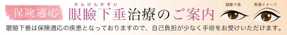 眼瞼下垂のご案内